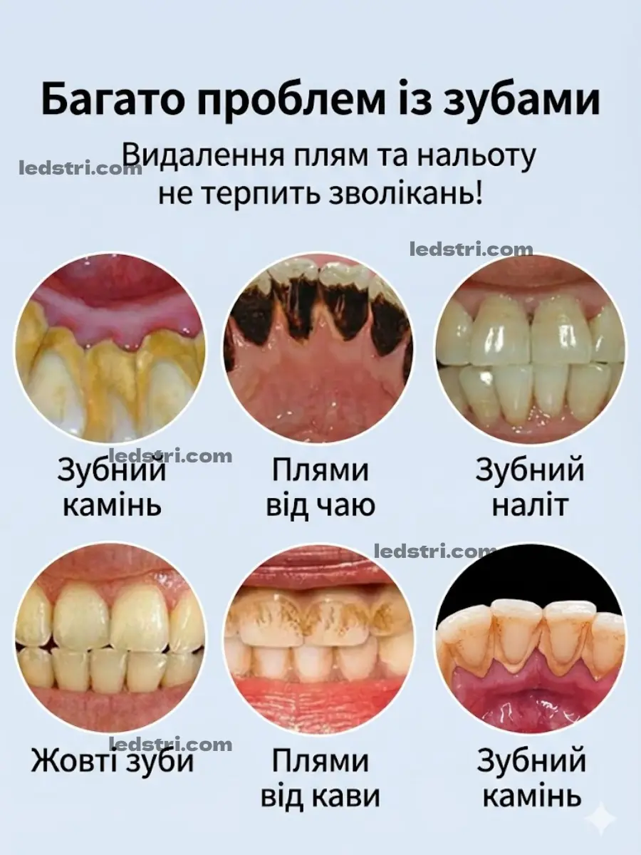 Проблеми з нальотом плямами та зубним каменем